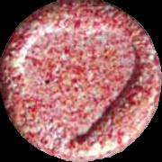 Heart sample 1974