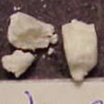 Crown ('Triple Stacked') sample 423