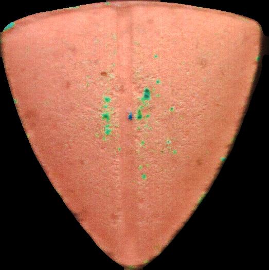 Tesla (Naranja) - MDMA 67mg (Front) pill — lab-tested sample